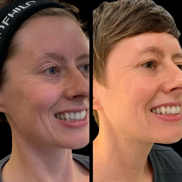 Best Plastic Surgeons in dubai