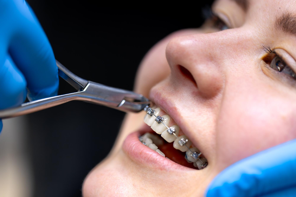 Orthodontics in Indirapuram